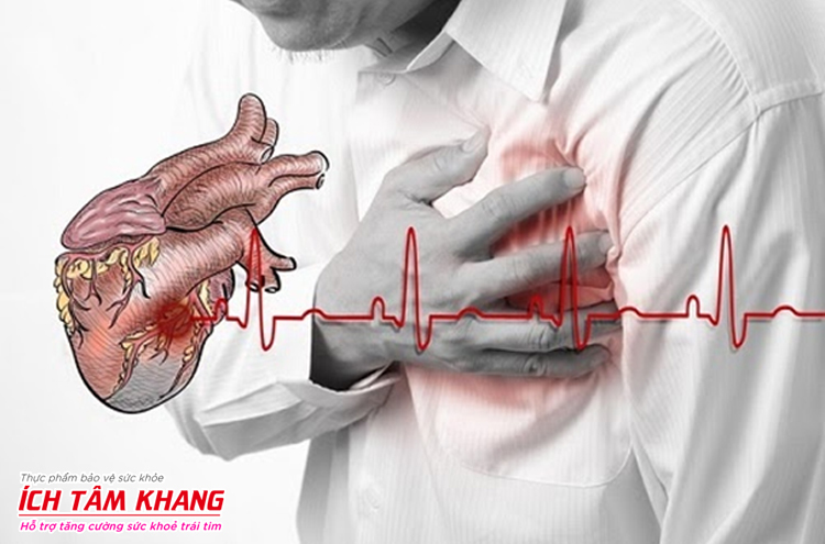 Các bệnh lý tim mạch là một trong những nguyên nhân dẫn đến đột quỵ
